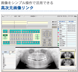 �摜���V���v������Ŋ��p�ł���@�������摜�����N